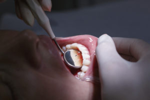 how oral health links to body