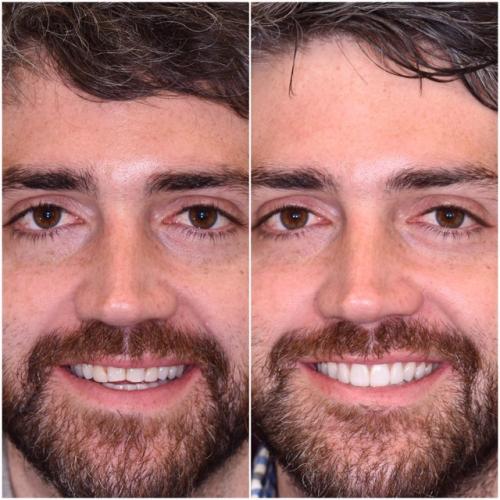 before-after-img32